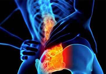 Back Pain Services
