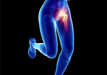 Hip Pain Services